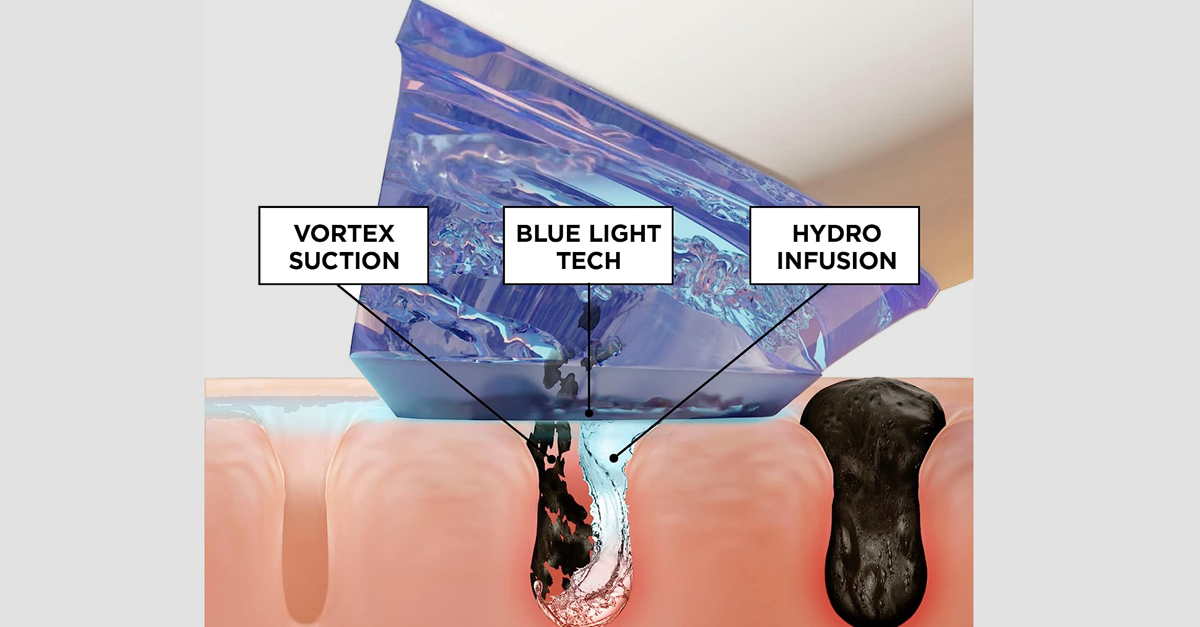 GLOfacial Hydro-Infusion Deep Pore Cleansing